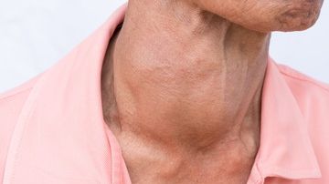 Şi bărbaţii au probleme cu tiroida! Care sunt semnele care trebuie să te îngrijoreze