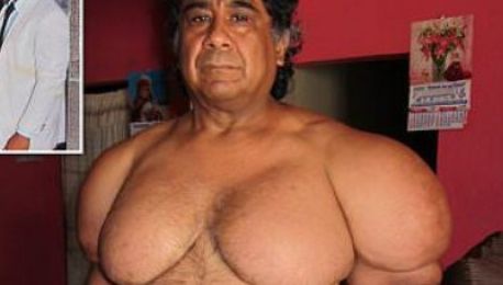 S-a îngrăşat 27 kg în doar câteva secunde, când a înotat de pe fundul apei către suprafaţă