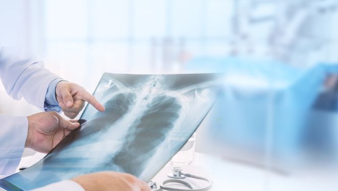 Explozie de cazuri de pneumonie, în România: copiii, cei mai afectați. Avertismentul medicilor 