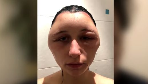 Aproape moartă, din cauza unei greşeli pe care şi tu o faci. Ce a desfigurat-o i-a şocat pe medici!