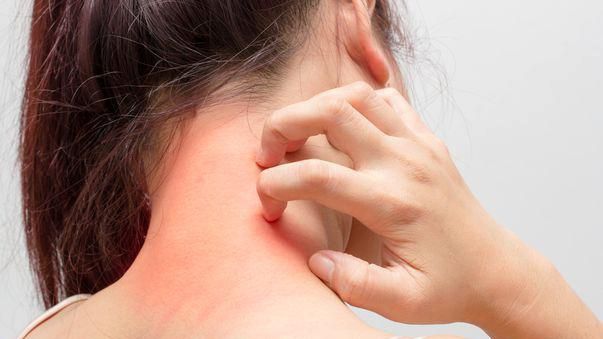 Cele mai grave forme de dermatită