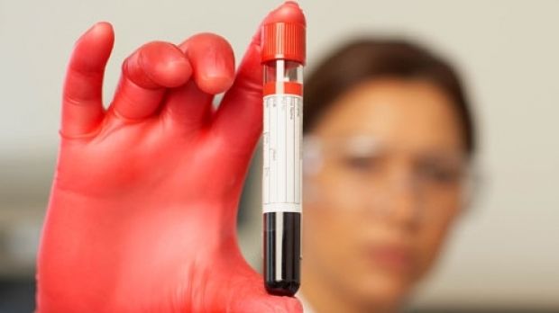 De ce sunt diferite persoanele cu Rh negativ? 