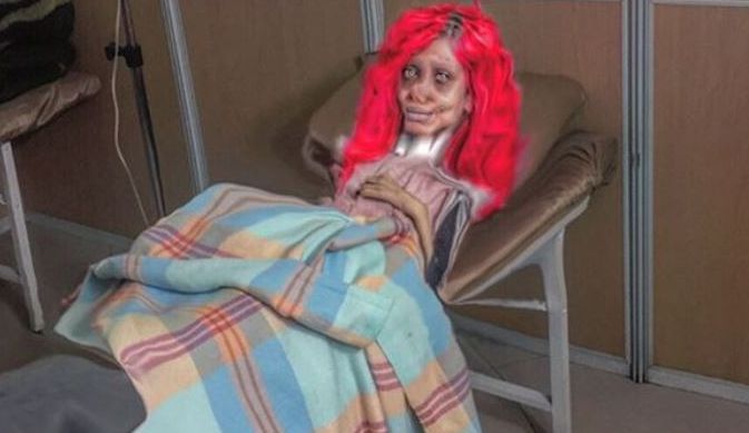 Zombie Angelina Jolie, iranianca de 21 ani, s-a autodistrus. Are acum 36 kg şi arată ca o vrăjitoare