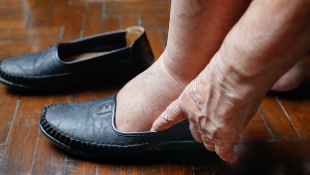 Cum poate fi combătută natural retenţia de apă