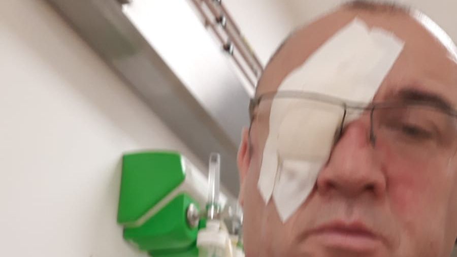 Mărturii după cafteala politică din Teleorman: ”S-a repezit în ochiul meu”. ”Minte, n-are pansament”