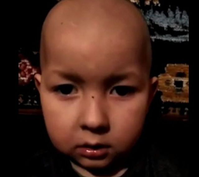 Un copil de 4 ani părea să aibă un banal oreion, dar diagnosticul e grav. Cum putem să-l ajutăm  