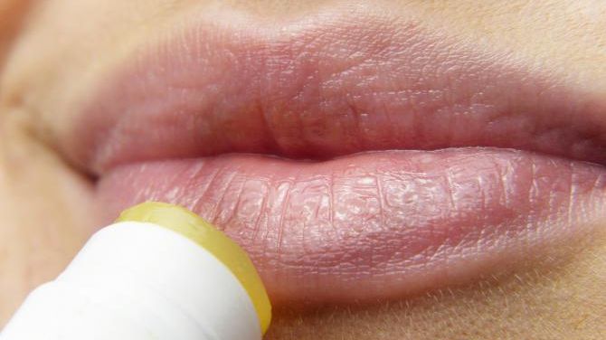 Herpes la buză. Este sau nu contagios? Tratament