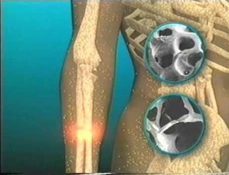 Acest aliment banal îţi scoate calciul din oase şi dinţi. Îl consumi zilnic!
