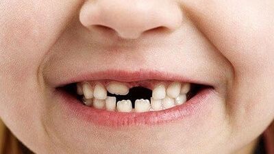 Ce înseamnă când visezi că îţi cad dinţii