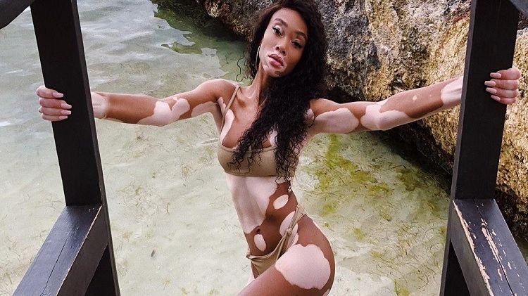 Modelul cu vitiligo care a intrat în premiră în paginile "Sports Illustrated Swimsuit"