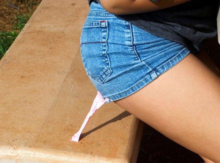 Cum scoți guma de mestecat lipită pe haine. Cele mai eficiente și surprinzătoare metode