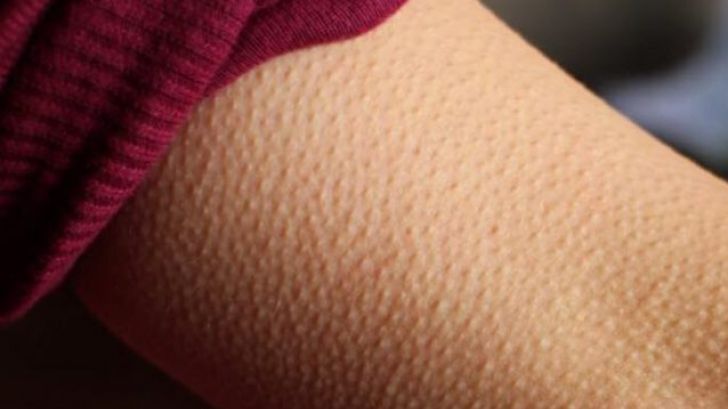 Ce înseamnă dacă ți se face ”pielea de găină” atunci când asculți muzică