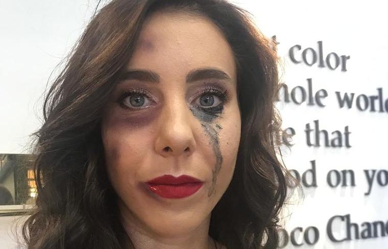 Miki Buzărnescu, imagine disperată: vânătă şi cu ochii în lacrimi