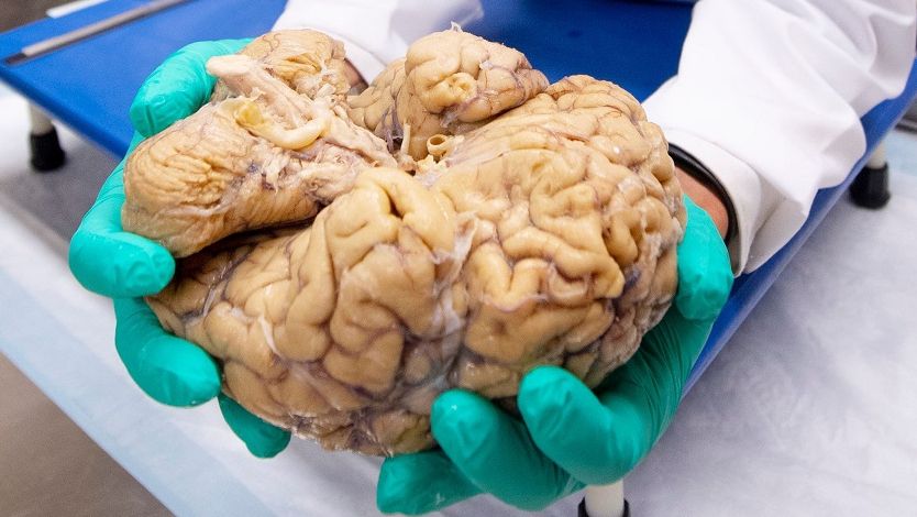 Diferența crucială dintre bărbați și femei! Specialiștii spun că totul începe de la creier