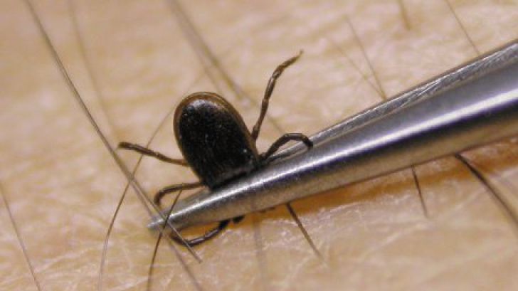 A început sezonul căpușelor! Ce trebuie să faci dacă ai fost mușcat