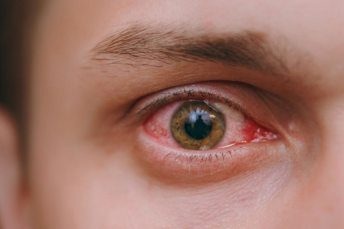 Ai probleme cu vederea? Acest fruct s-a dovedit miraculos. Specialiștii în domeniu îl recomandă 100%