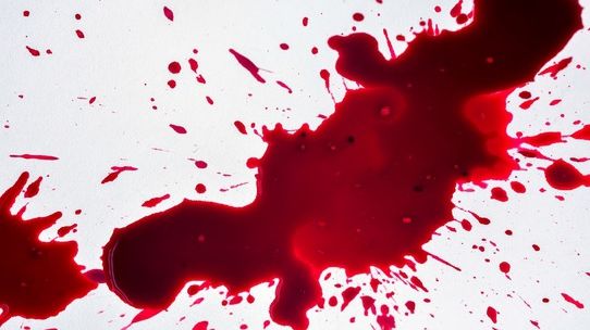 Ce înseamnă când visezi sânge. Drama din subconștient 