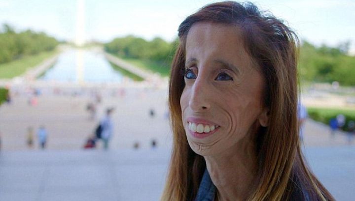 I s-a spus că e cea mai urâtă femeie din lume. Transformarea ei a servit o lecţie întregii lumi