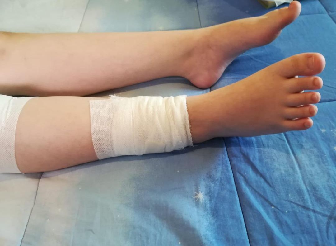  Caz șocant în Sibiu: Fetiță de 10 ani sfâșiată de un câine maidanez. FOTO