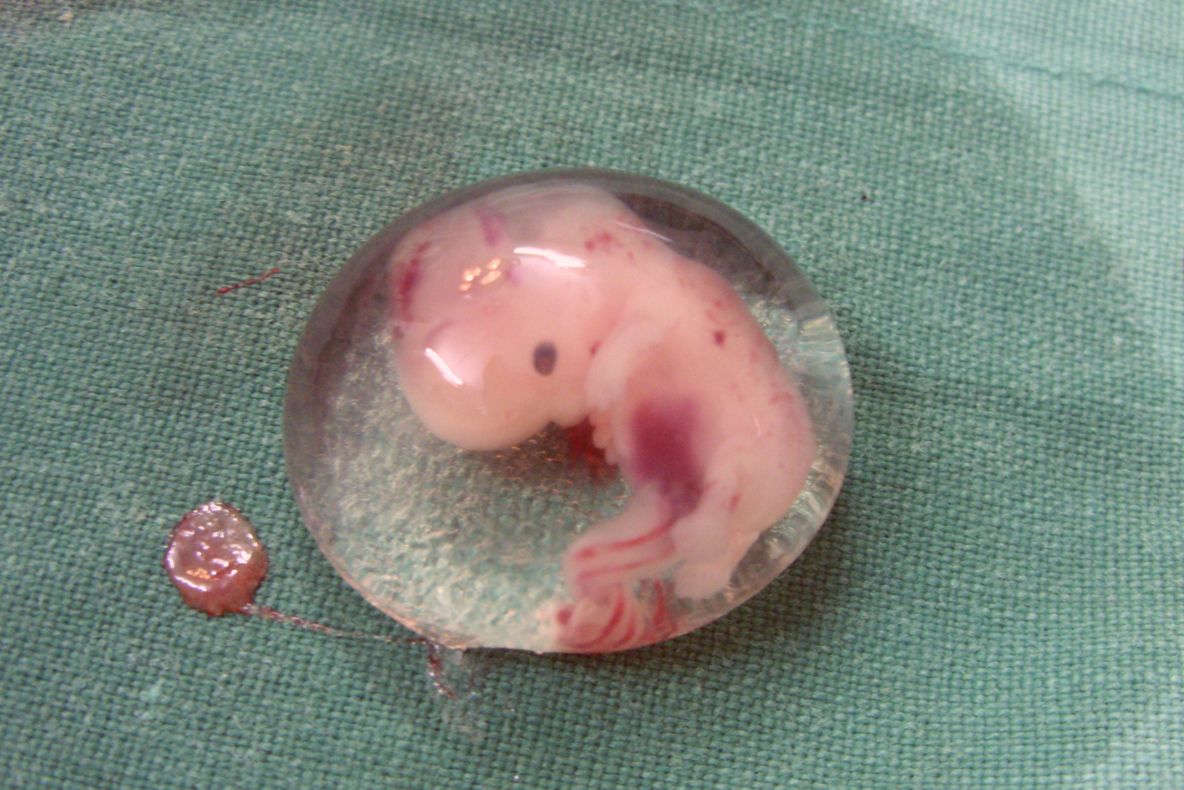 A fost creat primul embrion uman de laborator, fără a se folosi ovule si spermatozoizi