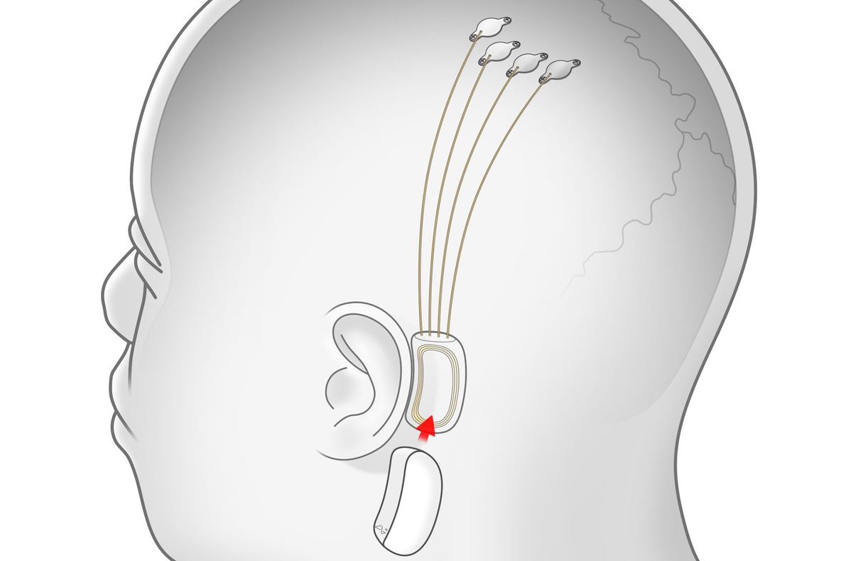 Miliardarul care vrea să microcipeze oamenii: ce face noul gadget propus pentru viitor