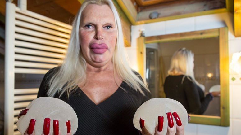 A cheltuit o avere pentru a arăta "perfect". AŞA este azi. Cum arăta ÎNAINTE? Te trec fiorii... 