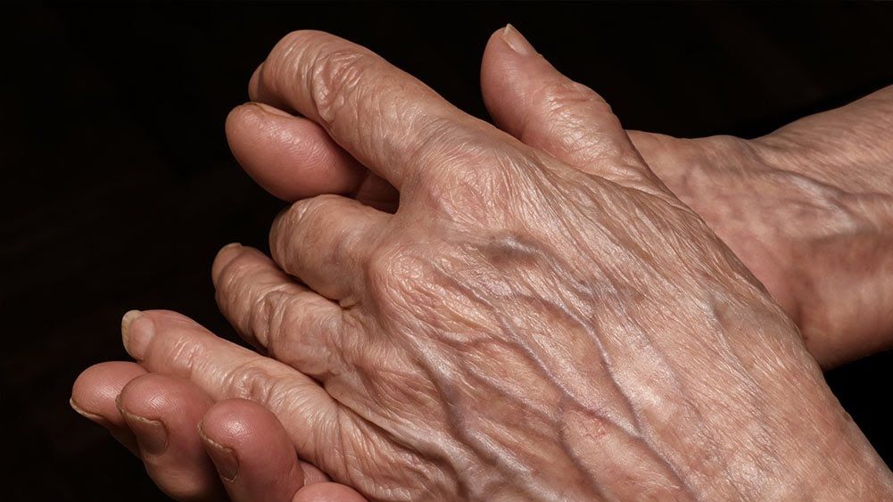 Sângele e roșu, dar venele se văd albastre. De ce? Cercetătorii explică fenomenul