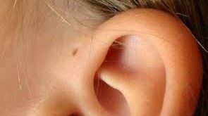Semnul de pe ureche care poate să prevestească grave probleme de sănătate - Descoperirea stranie a unui studiu medical
