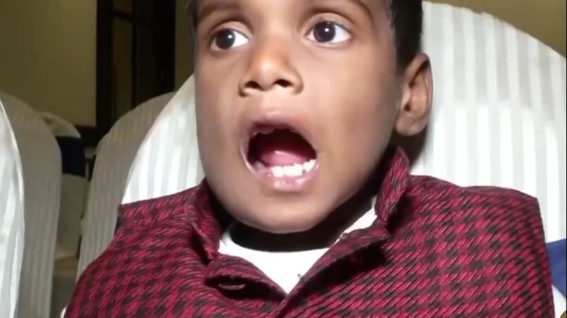 Unui copil de 7 ani i s-au scos 526 de dinți. Cazul a șocat lumea medicală 