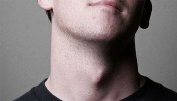 Trăsătura genetică importantă care diferențiază bărbații de femei