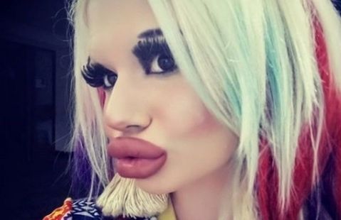 A dat o avere pentru a-și mări buzele: 15 operații, dar nu se oprește aici! Cum arăta înainte 