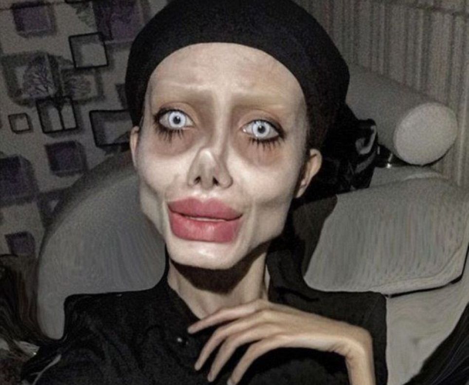 Femeia care s-a operat să semene cu Angelina Jolie a fost arestată 