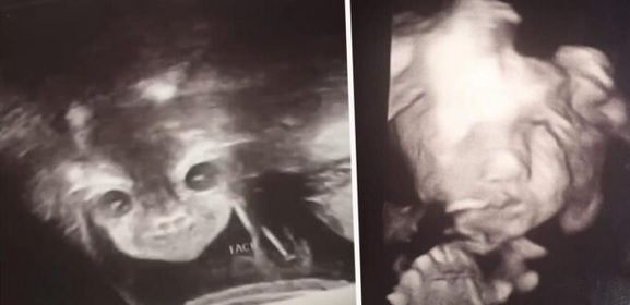 La ecografie, a urmat șocul: "E copilul diavolului! Mi se uită direct în suflet!" Ce purta în pântec