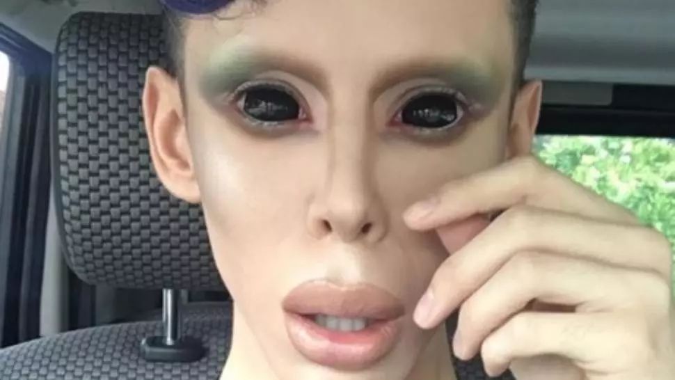 A cheltuit o avere pentru a deveni un extraterestru fără sex: "Nu vreau să mai am nimic acolo jos!"