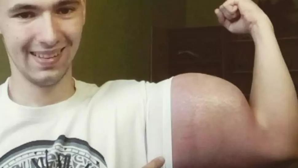 Băiatul cu braţele cât Popeye şochează din nou! Cum arată iubita lui. Imagini tulburătoare