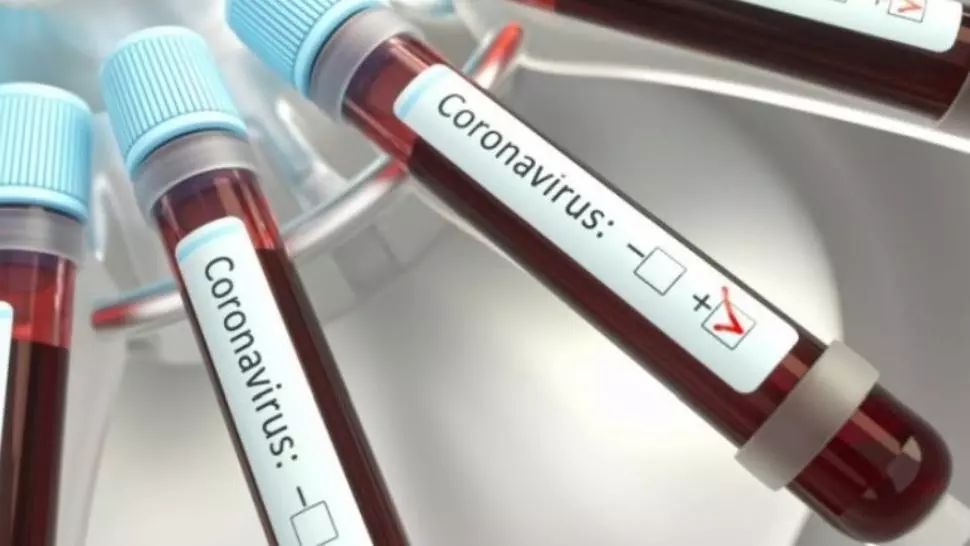 VIDEO Nelu Tătaru: Capacitatea de testare va crește până la 6.000 pe zi după sărbătorile pascale