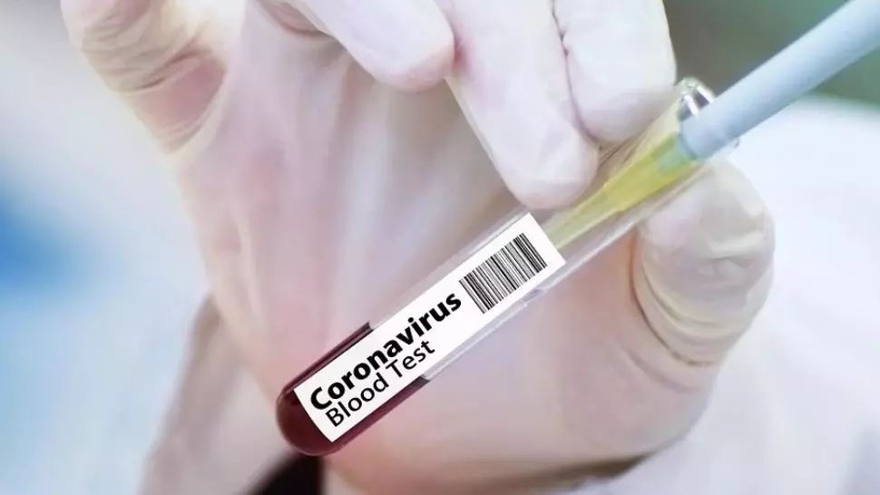 Rafila: 650 de persoane mor zilnic în România, în mod curent. Rămâne să vedem câte sunt cazuri COVID-19