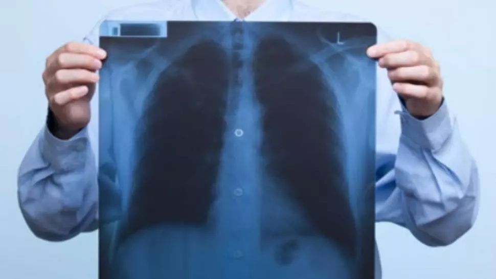 Dacă fumezi, mănâncă asta de două ori pe săptămână ca să reduci la jumătate riscul de cancer