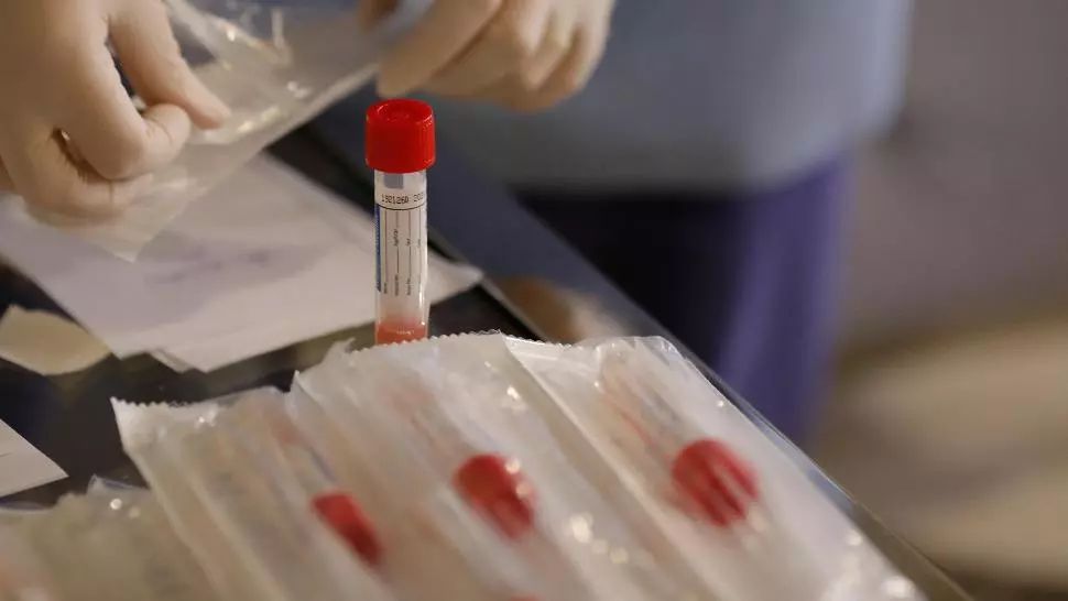 Alexandru Rafila: Vom extinde testarea pentru coronavirus la mai multe categorii de persoane 