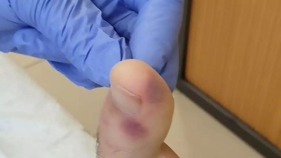 Uita-te atent la picioare, ai putea afla din timp dacă ai COVID