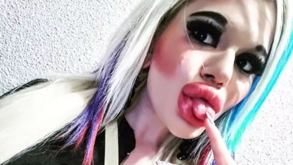 Povestea studentei din Bulgaria care și-a mărit buzele de 15 ori. Și nu se oprește aici! Cum arăta înainte 