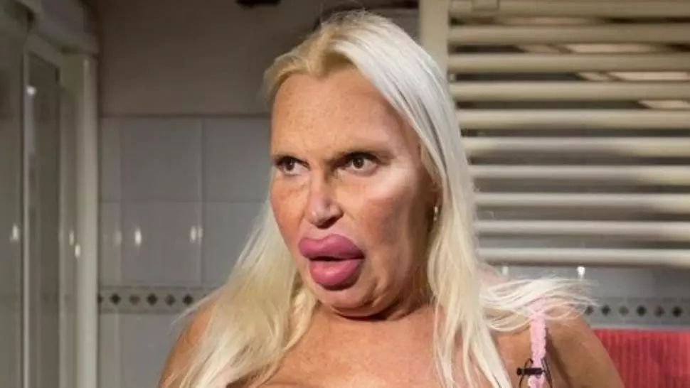 A cheltuit o avere pentru a arăta "perfect". AŞA este azi. Cum arăta ÎNAINTE? Transformare incredibilă 