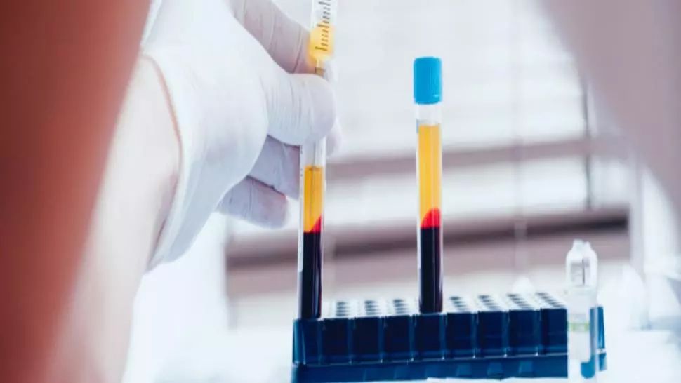 Pacienții vindecați de COVID-19 au început să doneze plasmă pentru cei grav bolnavi