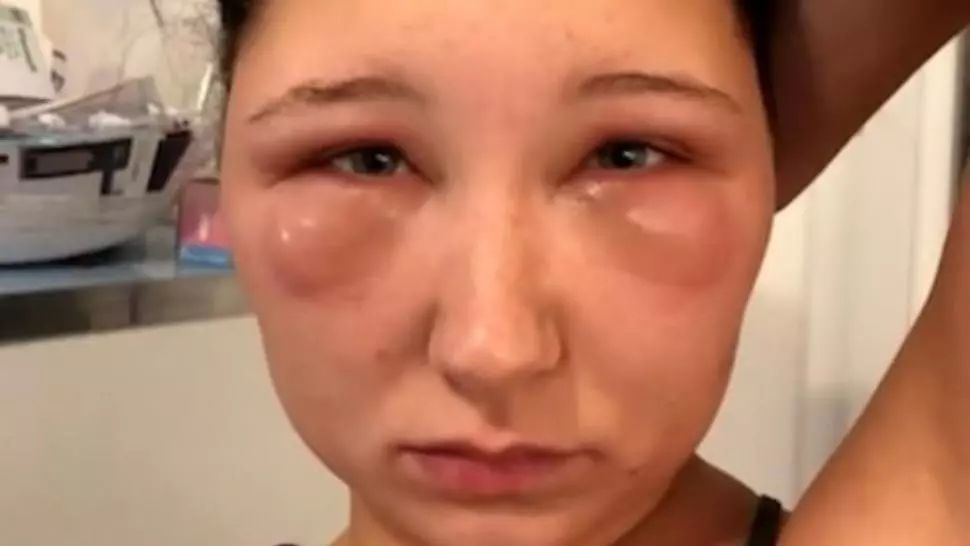 La un pas de moarte, după ce și-a vopsit părul. Greșeala pe care și tu o faci