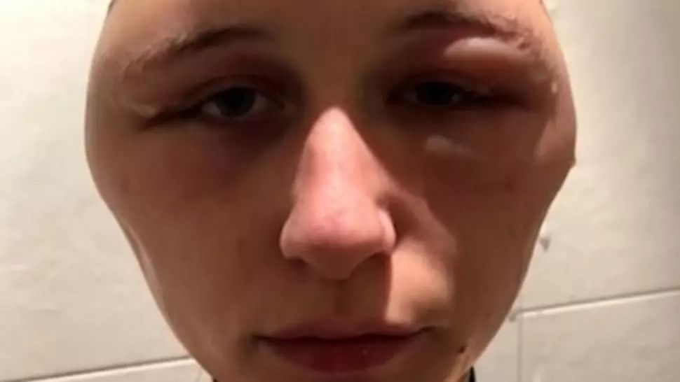 Aproape moartă, din cauza unei greşeli pe care şi tu o faci. Ce a desfigurat-o i-a şocat pe medici