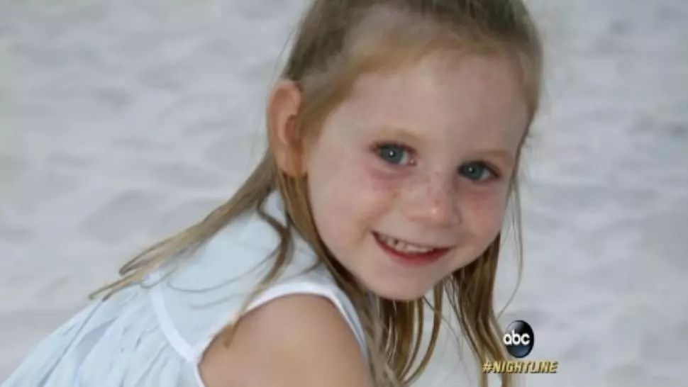 De fiecare dată când ieşea din casă, pielea îi lua foc şi avea dureri cumplite! Apoi a aflat SECRETUL