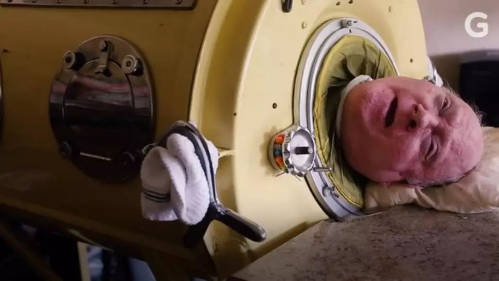 Povestea tulburătoare a bărbatului care a trăit o viaţă încorsetat în "plămânul de fier"