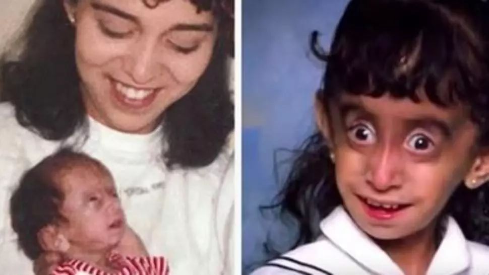 Îi spuneau că este un monstru care trebuie ucis cu foc! După 25 de ani, tânăra a şocat cu apariţia sa!