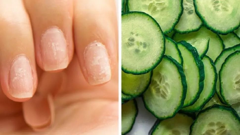 8 remedii naturale care pot face minuni pentru unghiile tale