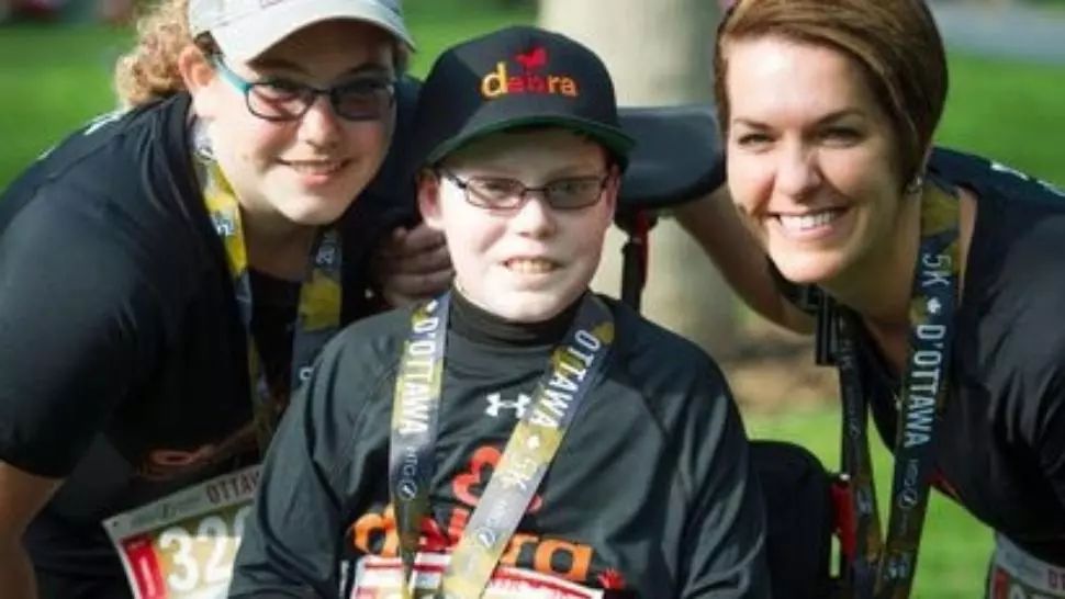 Povestea tulburătoare a băiatului cu pielea sensibilă ca aripa unui fluture